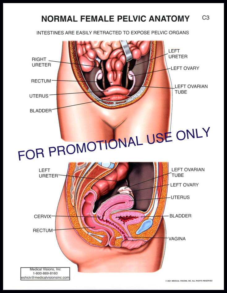C3 Normal Female Pelvic Anatomy